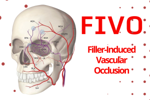 Filler-Induced Vascular Occlusion (FIVO) Craniofacial Arterial Map - Educational Graphic for Aesthetic Practitioners