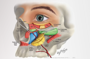 Detailed illustration of midface anatomy showing facial fat compartments, vascular structures, retaining ligaments, and danger zones relevant for injectable filler safety, including infraorbital and angular arteries.