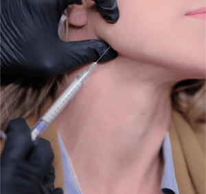 Radiesse syringe being injected along the jawline of a female model during a Heddy training, showing mandibular sculpting technique.