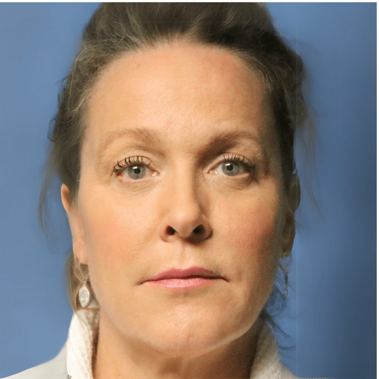 Profile picture of Kim Kirkwood, Practice Manager, alongside her testimonial about Heddy’s hands-on training and mentorship in medical aesthetics.