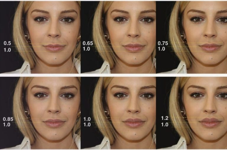 Composite facial images demonstrating the effect of varying upper-to-lower lip ratios (0.5:1 to 1.2:1) used for aesthetic consultation in the Step-by-Step Phi Technique for lip augmentation.