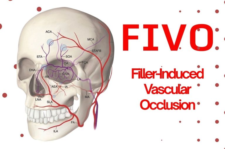 Anatomical illustration of the facial arterial network showing internal and external carotid branches relevant to filler-induced vascular occlusion.