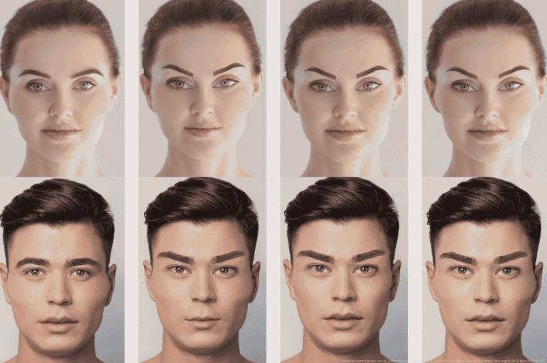 Frontal images of male and female faces showing progressive modifications: overfilled cheeks, lip enhancement, and lateral canthal lift, used in a study on facial overfilled syndrome (FOS).