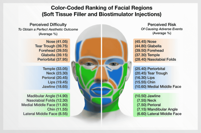 Color-coded facial map ranking difficulty and risk of soft tissue filler and biostimulator injections by region.