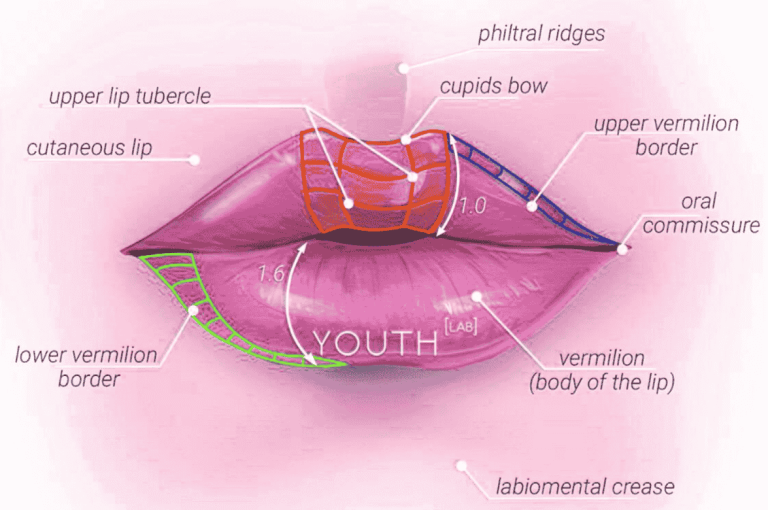 Diagram of lip anatomy showing Cupid’s bow, philtral ridges, upper and lower vermilion borders, and key injection zones for lip augmentation.