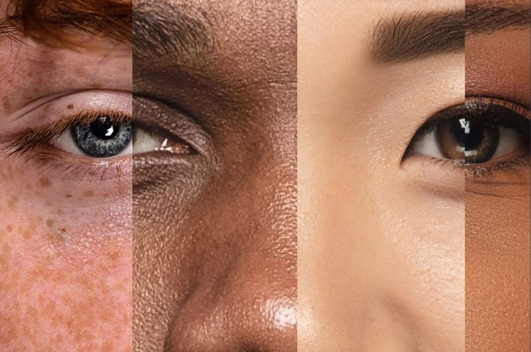 Close-up composite of four diverse skin tones, illustrating inclusive aesthetics in Allergan Aesthetics’ Moving the Needle on Ethics publication. Image credit: Allergan Aesthetics – Moving the Needle on Ethics. PDF source