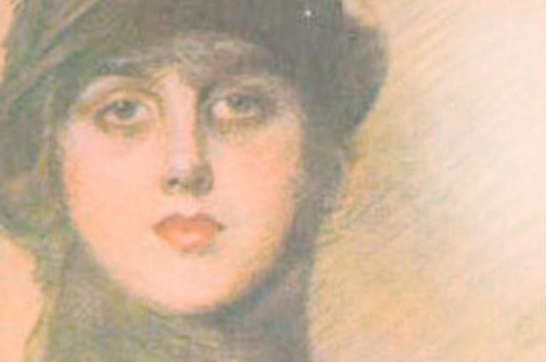 Gladys Spencer-Churchill disfigured by paraffin injections – early injectable filler cautionary tale.