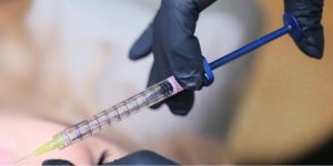 Injector administering Restylane Kysse during a Heddy training session, demonstrating precision filler technique on a live model.