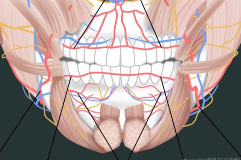 Lip and philtrum filler injection anatomy diagram showing arteries, muscles, and safe injection zones