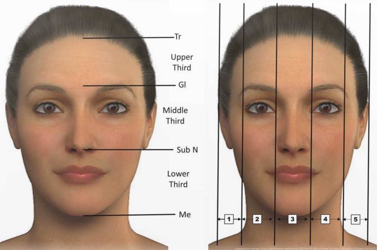 Facial thirds and vertical proportions diagram showing anatomical landmarks for filler and botulinum toxin injection planning and facial contouring