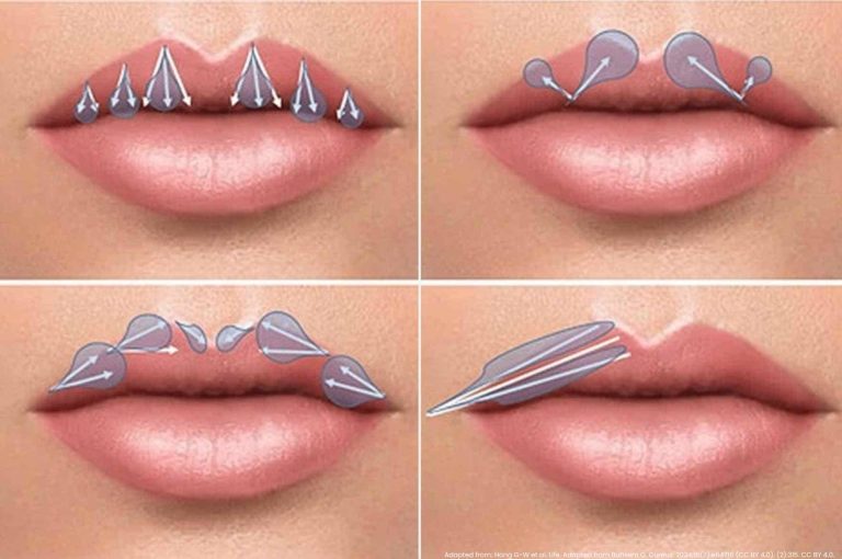 Image adapted from: Buhsem O. Cureus. 2024;16(7):e64716. DOI: 10.7759/cureus.64716