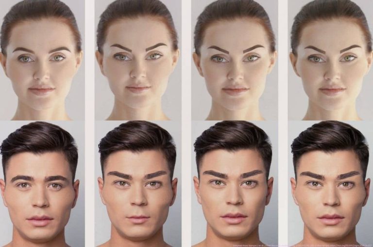 Frontal images of male and female faces showing progressive modifications: overfilled cheeks, lip enhancement, and lateral canthal lift, used in a study on facial overfilled syndrome (FOS).