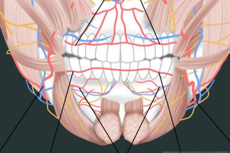 Detailed anatomical illustration of the perioral region showing the maxilla, mandible, facial musculature, and color-coded vascular and nerve structures with black injection vector lines overlaid, demonstrating anatomically guided filler placement zones for lip and philtrum augmentation, adapted from Hong G-W et al., Life, 2025, CC BY 4.0