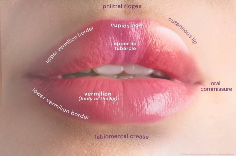 Annotated clinical photograph of female lips identifying key anatomical landmarks including the cupid's bow, philtral ridges, upper and lower vermilion borders, upper lip tubercle, cutaneous lip, oral commissure, and labiomental crease — reference guide for lip filler injection technique