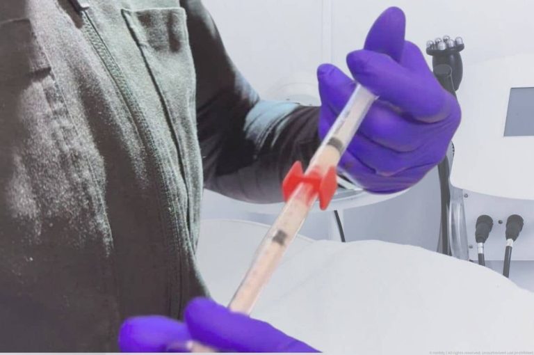 Gloved injector preparing a syringe in a modern medical aesthetics treatment room, representing clinical readiness and operational standards in private equity-owned med spa due diligence
