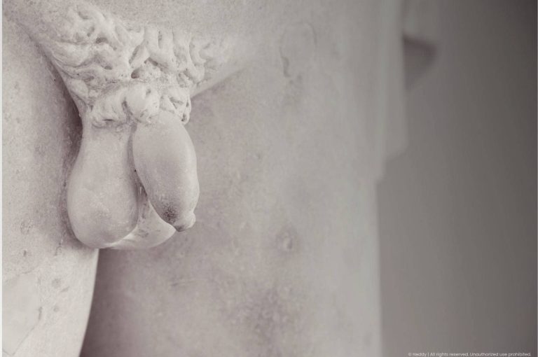 Close-up photograph of a classical marble sculpture depicting male genitalia, representing penile girth enhancement with PMMA polymethylmethacrylate soft tissue filler in male genital aesthetic medicine
