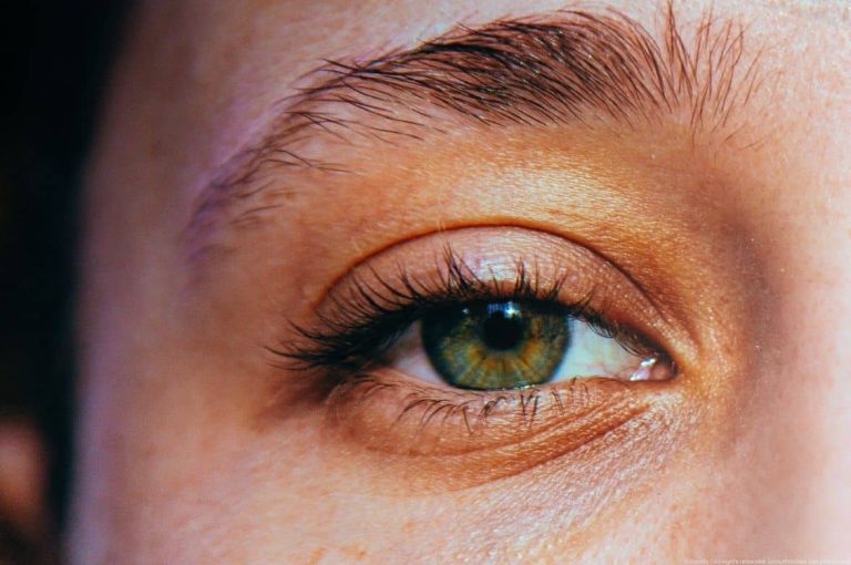 Close-up of a green eye and upper eyelid, illustrating the anatomical area for treating mild ptosis and eyelid asymmetry with botulinum toxin injections.