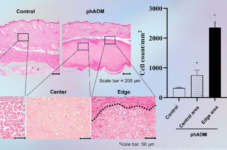 Stained sections of rat skin one week after a human acellular dermal matrix injection, with close-ups of the implant's center and edge and a bar chart showing fibroblast density highest at the edge.